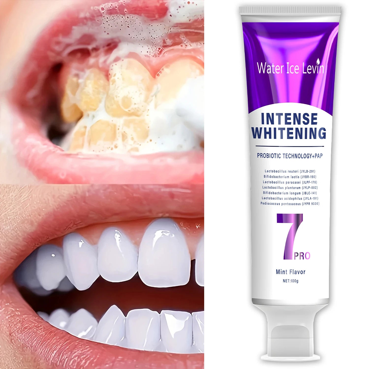 Probiotic Whitening Toothpaste - Helps Maintain Healthy Gums, Keeps Breath Fresh, Oral Care Set - Suitable for the Whole Family Qme