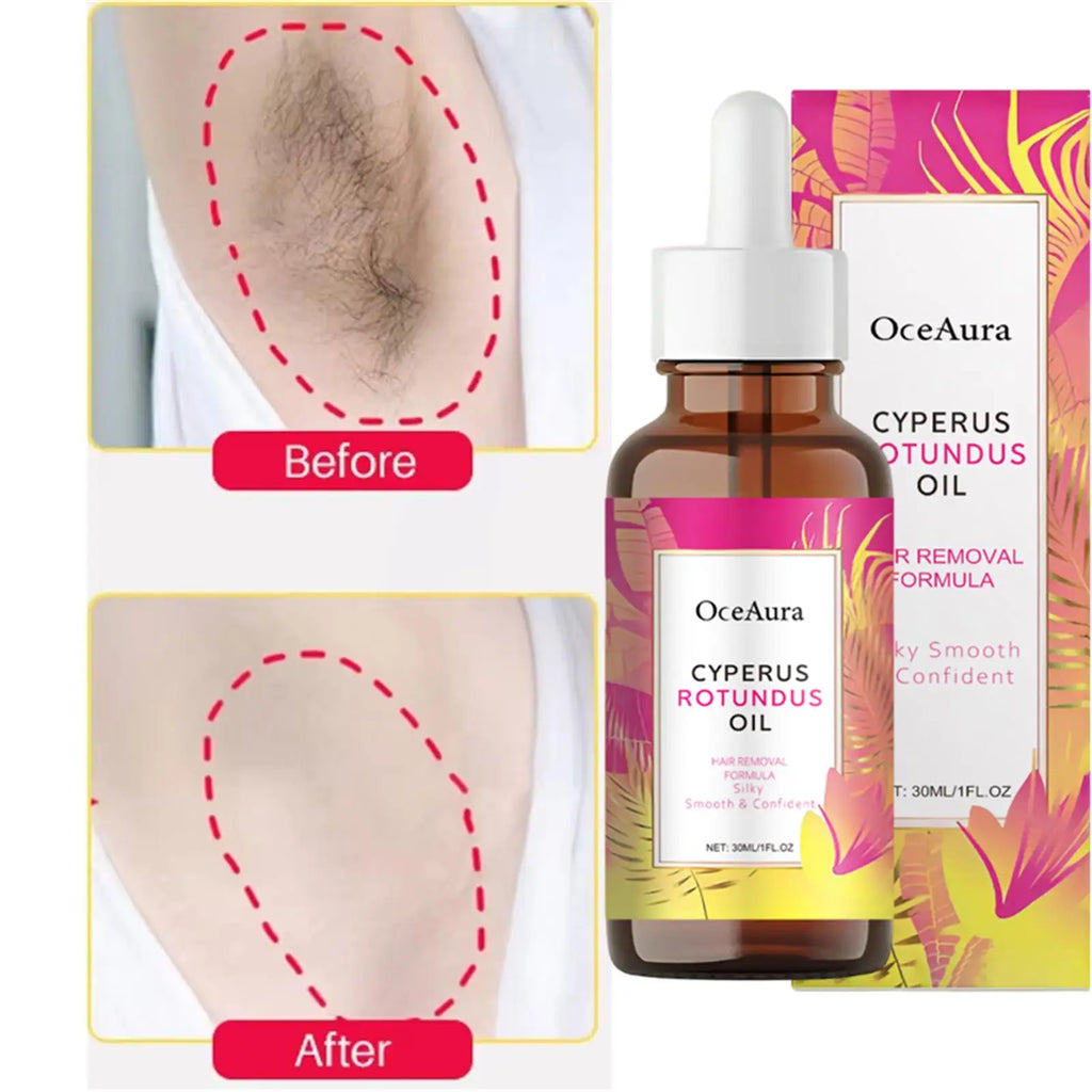 Cyperus Rotundus Oil for Hair Removal Smoothing Soothing Skin Care Moisturizes Armpit Leg Arm Hair Inhibitor Depilatory Oil Qme