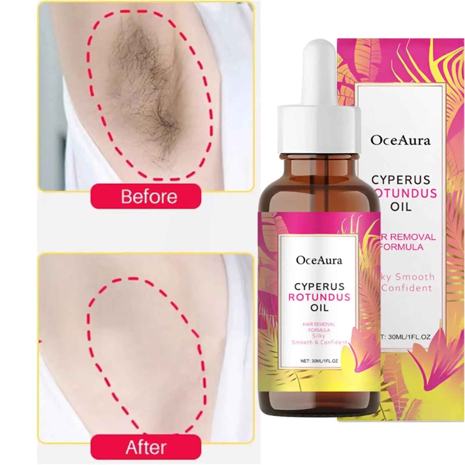 Cyperus Rotundus Oil for Hair Removal Smoothing Soothing Skin Care Moisturizes Armpit Leg Arm Hair Inhibitor Depilatory Oil Qme