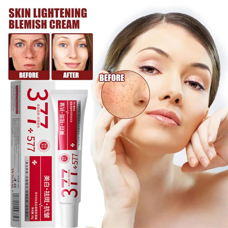 Powerful Spot-Removing Whiten Cream Brighten Skin Fast Eliminates Melanin Pigmentation Melasma Dark Spots Korean Face Skin Care Qme