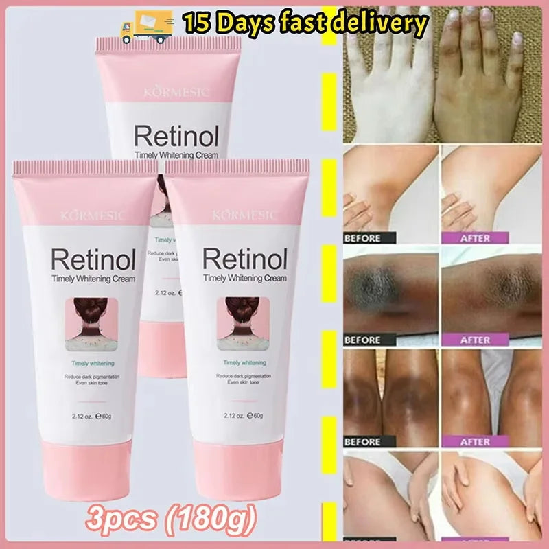 Retinol Whitening Cream Private Parts Underarm Bleaching Neck Lift Firm Butt Knee Brighten Inner Thigh Dark Remove Melanin 60g Qme 3pc