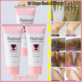 Retinol Whitening Cream Private Parts Underarm Bleaching Neck Lift Firm Butt Knee Brighten Inner Thigh Dark Remove Melanin 60g Qme 3pc
