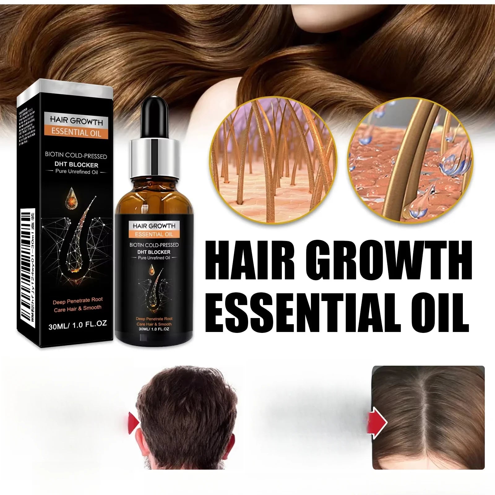 High Repurchase,Hair Growth Oil,Biotin DHT Blocker,Anti-Loss Shampoo,Boost Regrowth,Increase Production of Shampoo,hair Growth Qme