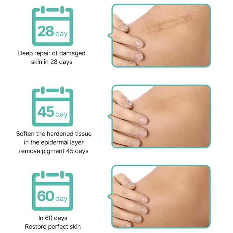 Stretch Marks Repair Cream Fade Lines Improve Duliness Tightness Long-lasting Moisturizing Smooth Enhance Elasticity Body Care Qme