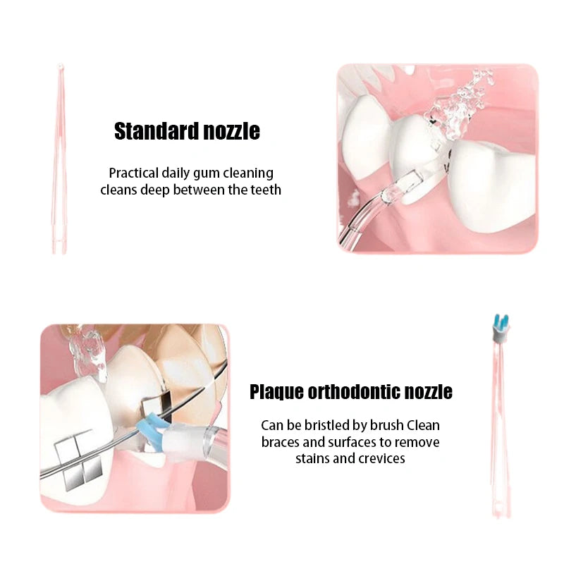 Dental Nozzles Oral Irrigator Replaceable Water Jet Mouthwash Flosser Qme