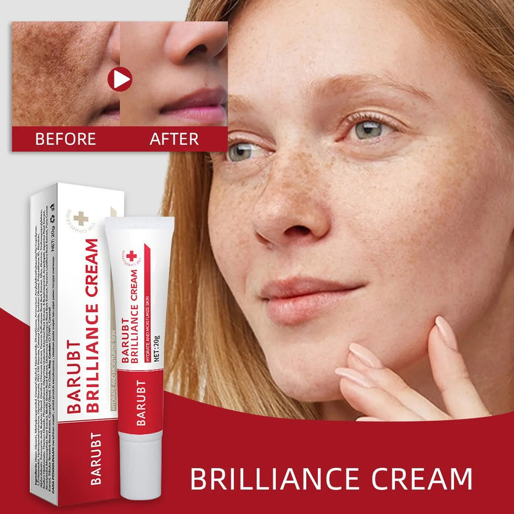 Whitening Freckles Face Cream Removal Melasma Dark Spots Corrector Lighten Melanin Pigmentation Brighten Anti-Aging Beauty Care Qme