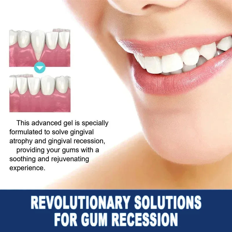 Rapid Repair Gums Gel Effectively Relieve Tooth Allergy Dental Caries Tooth Cleaning Toothpaste Relieve Tooth Damage Serum Qme