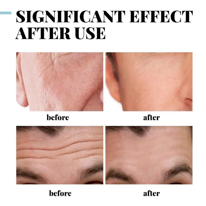 Anti-Wrinkle Cream for Men Mild Moisturizing Removing Wrinkles Firming Lifting Neck Fade Fine Lines Anti-Aging Facial Treatment Qme