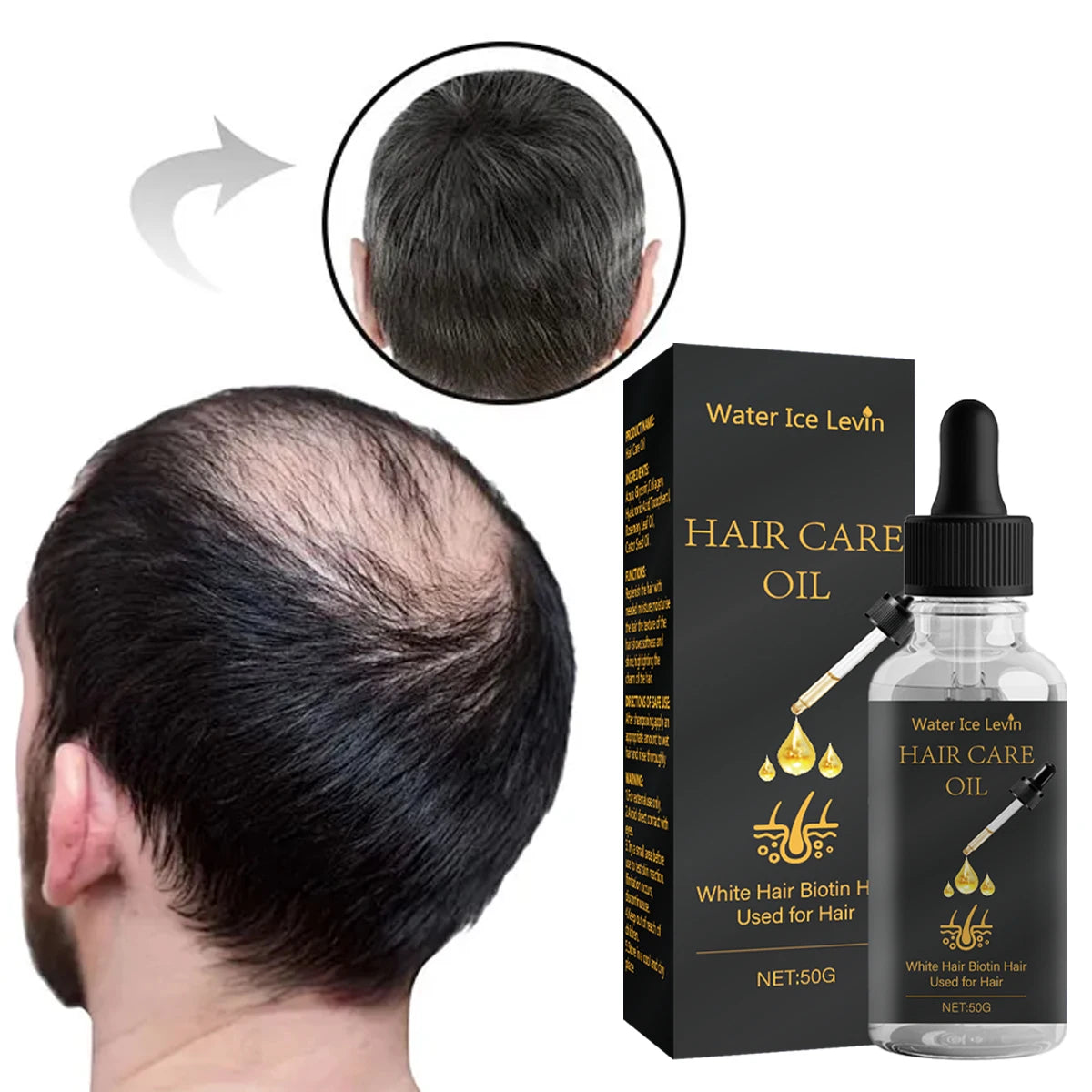 Hair Care Oil with Biotin - Fights White Hair & Boosts Moisture with Rosemary, Castor Oil, Collagen for Soft, Shiny Hair Qme