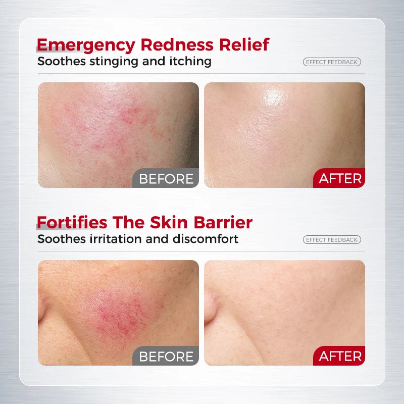 Hydrating Soothing Essence Cream Collagen Ceramides Hyaluronic Acid Qme