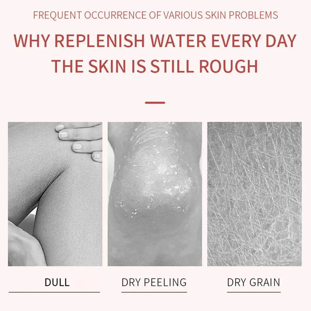 Anti-drying Foot Cream Crack Resistance Special Care Nourishing Qme