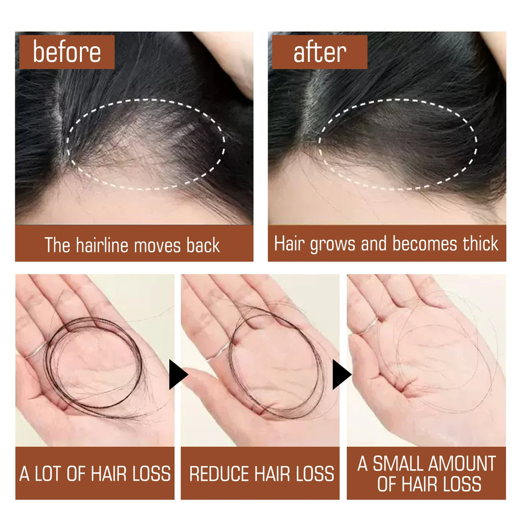 100% Pure Organic Hair Mask Batana Oil Hair Growth Oil Natural Treatment Nourish Reduce Hair Loss Anti-Breakage Qme