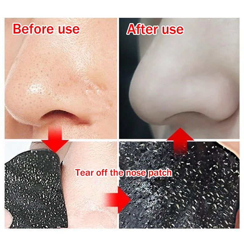 5 15 25 Bamboo Charcoal Nose Pore Strips Deep-cleaning Blackhead Qme