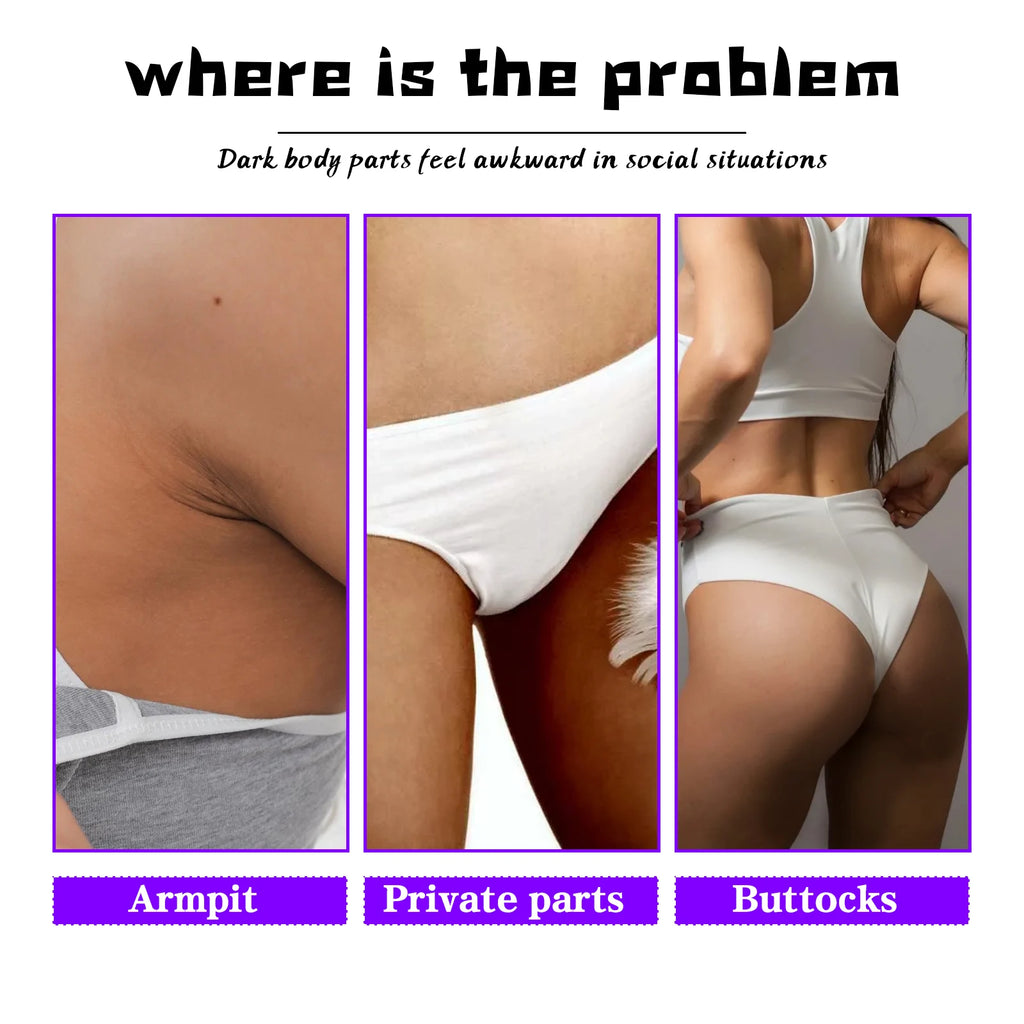 Inner Thighs Lightening Cream Private Area Armpit Buttock Dark Spots Whitening Lotion Body Brighten Melanin Even Skin Tone Qme