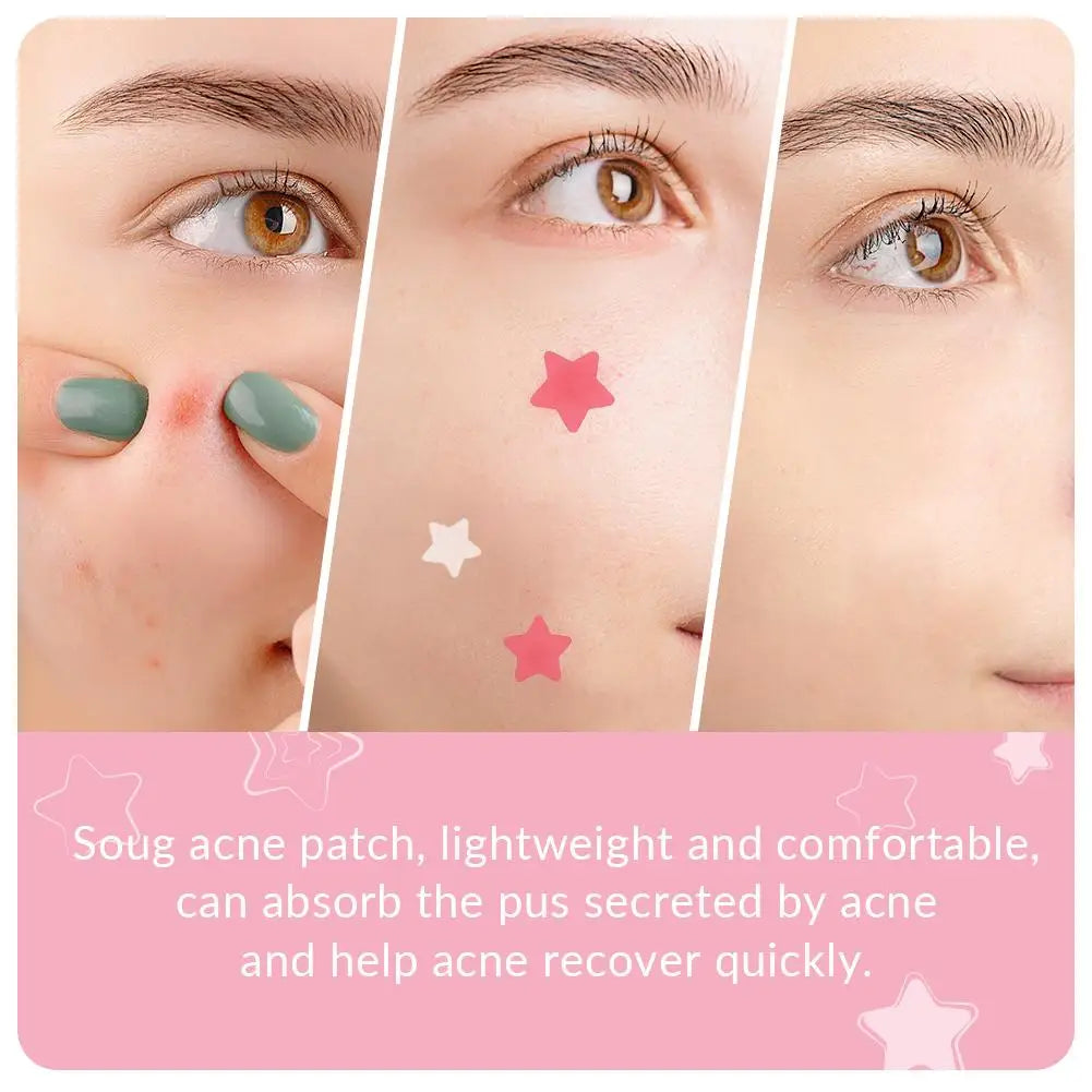 240Pcs Cute Star Acne/Pimple Patch Acne Treatment Stickers Invisible Acne Stars Cover Face Spot Removal Pimple Patch Skin Care Qme