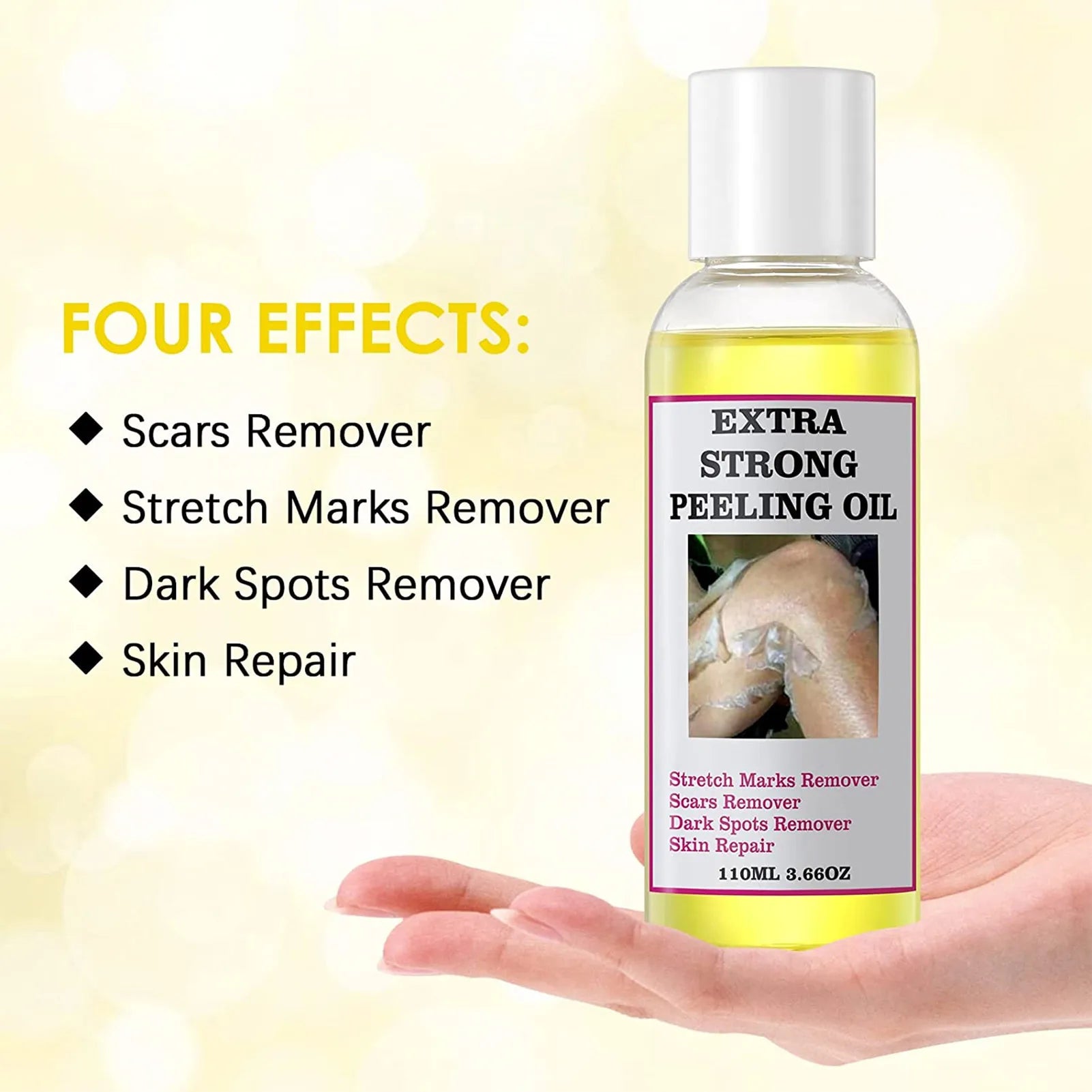 Peeling Oil Yellow Dark Spots Body Thai Hyaluronic Acid Strong Extra Qme