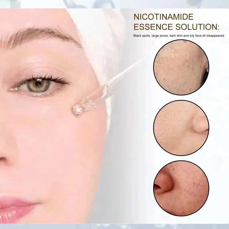 Salicylic Acid Pore Shrinking Serum Quick Elimination Large Pores Remove Blackhead Acne Tighten Smooth Skin Korean Care Product Qme