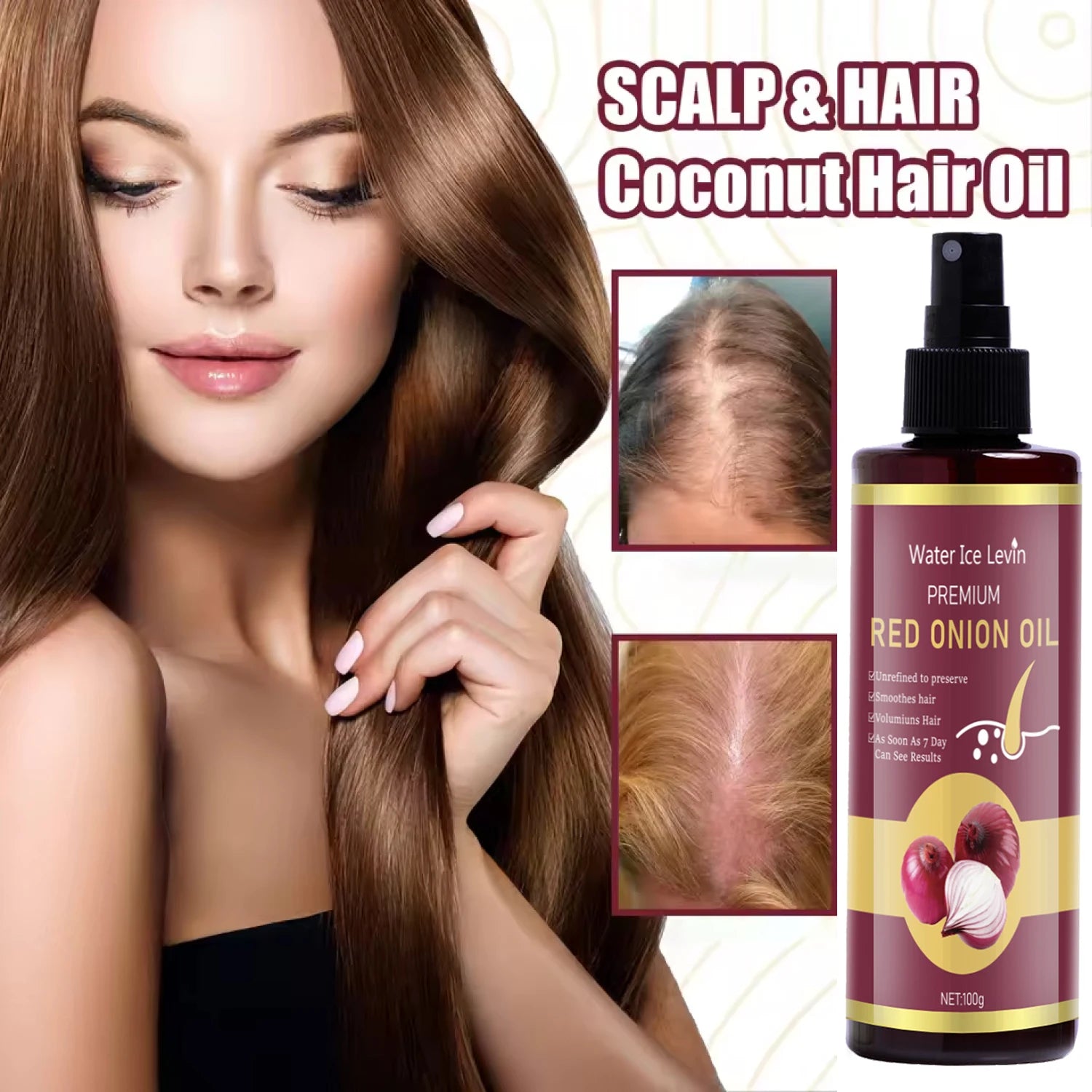 Red Onion Hair Oil—Moisturizing and Hydrating Hair Care Essence, Nourishes and Smooths Hair, Suitable for All Hair Types, 100g Bottle/Travel-Friendly Qme