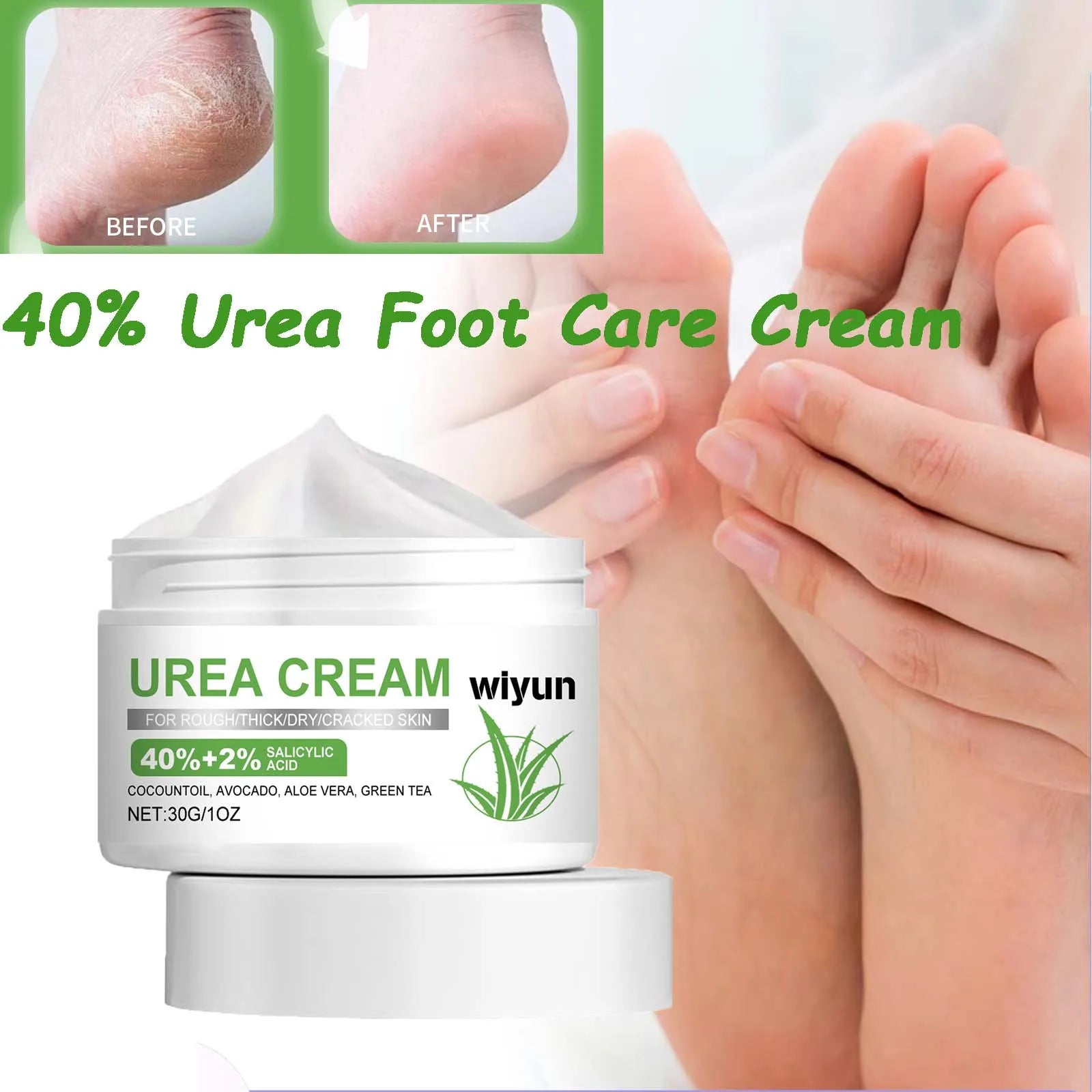 40% Urea Foot Care Cream Overnight Moisturizing Removes Dead Skin Nourishing Dry Rough Repair Cracked Heels & Calluses Moisture Qme