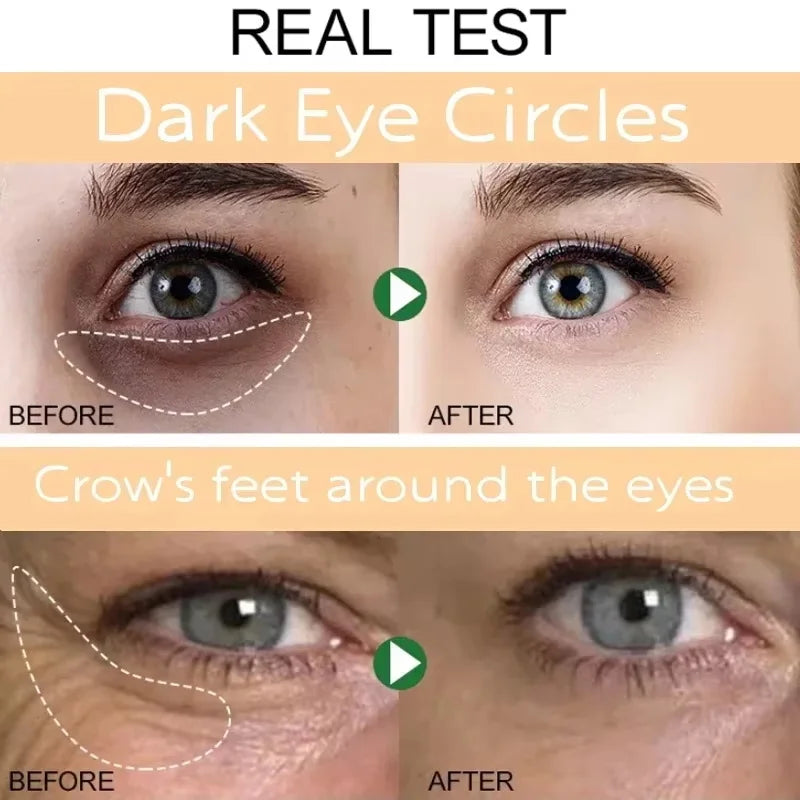 Instant Eye Bag Remove Eye Cream Anti Fat Particles Dark Circles Puffiness Fade Fine Lines Lift Brighten Korean Beauty Eye Care Qme