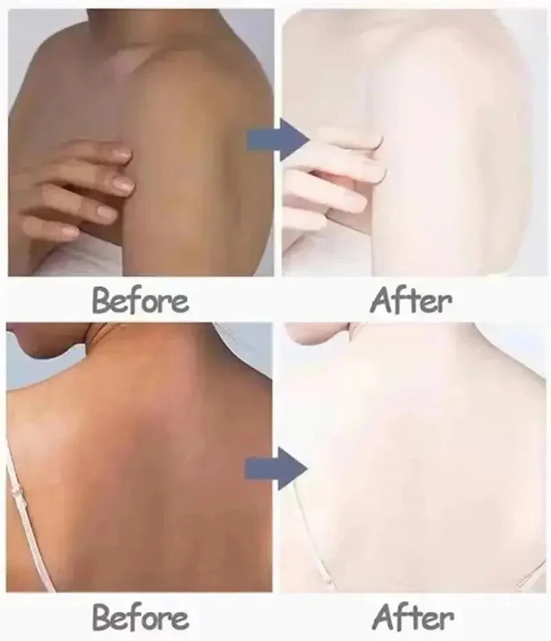 Body Whitening Cream Private Parts Underarm Knee Thigh Inner Melanin Bleaching Brighten Lotion Dark Skin Healthy White Body Care Qme