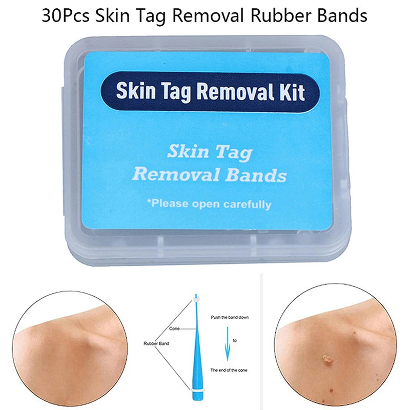 Skin Care Tools Tag Removal Rubber Bands Micro Band Non Toxic Face Qme