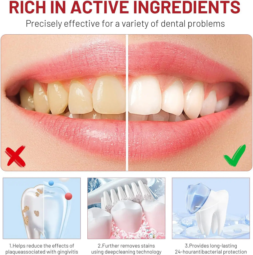 Niacinamide Whitening Toothpaste Intensive Whitens Teeth Protects Qme