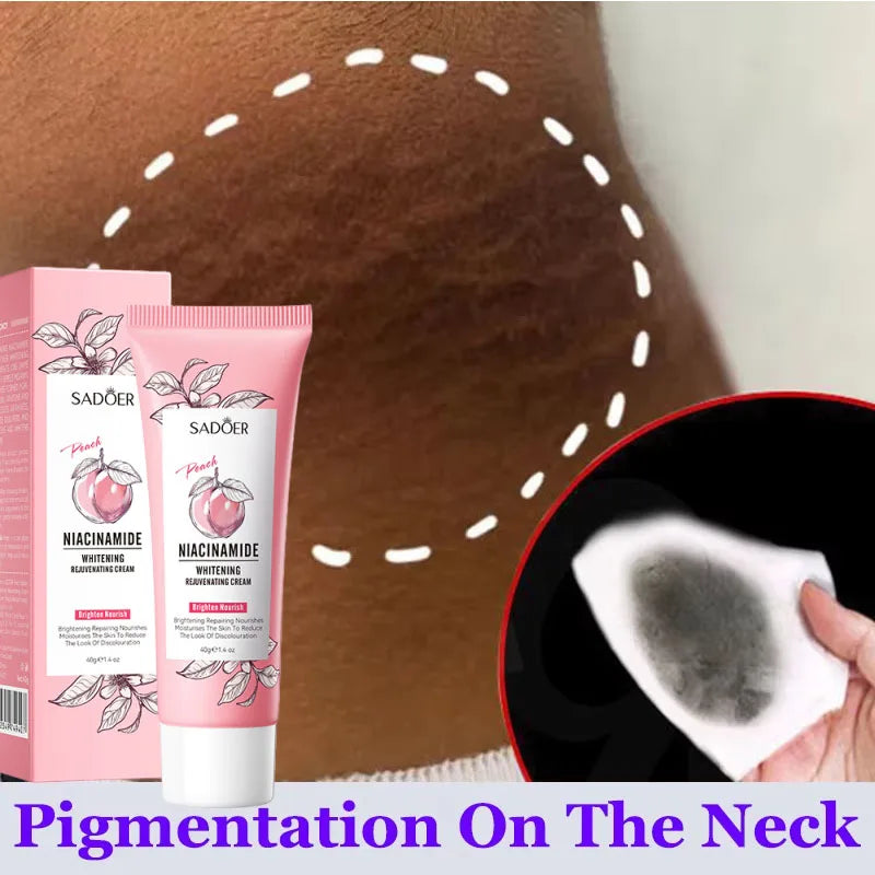Whitening Body Cream For Dark Skin Armpit Thigh Inner Joint Fade Intimate Area Underarm Body Care Private Part Brighten Lotion Qme