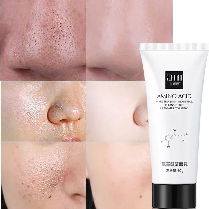 Nicotinamide Amino Acid Face Cleanser Facial Scrub Cleansing Acne Oil Control Blackhead Remover Shrink Pores Skin Care Qme
