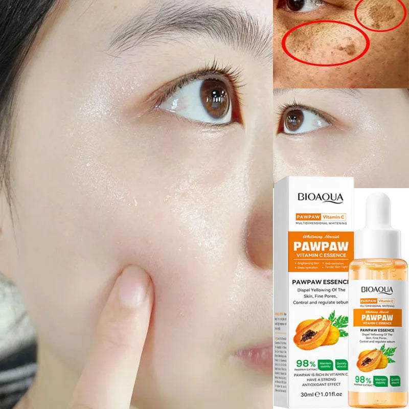 Papaya VC Brightening Serum Improve Dullness Remove Dark Spots Effective Whiten Freckle Product Moisturize Face Skin Care Beauty Qme