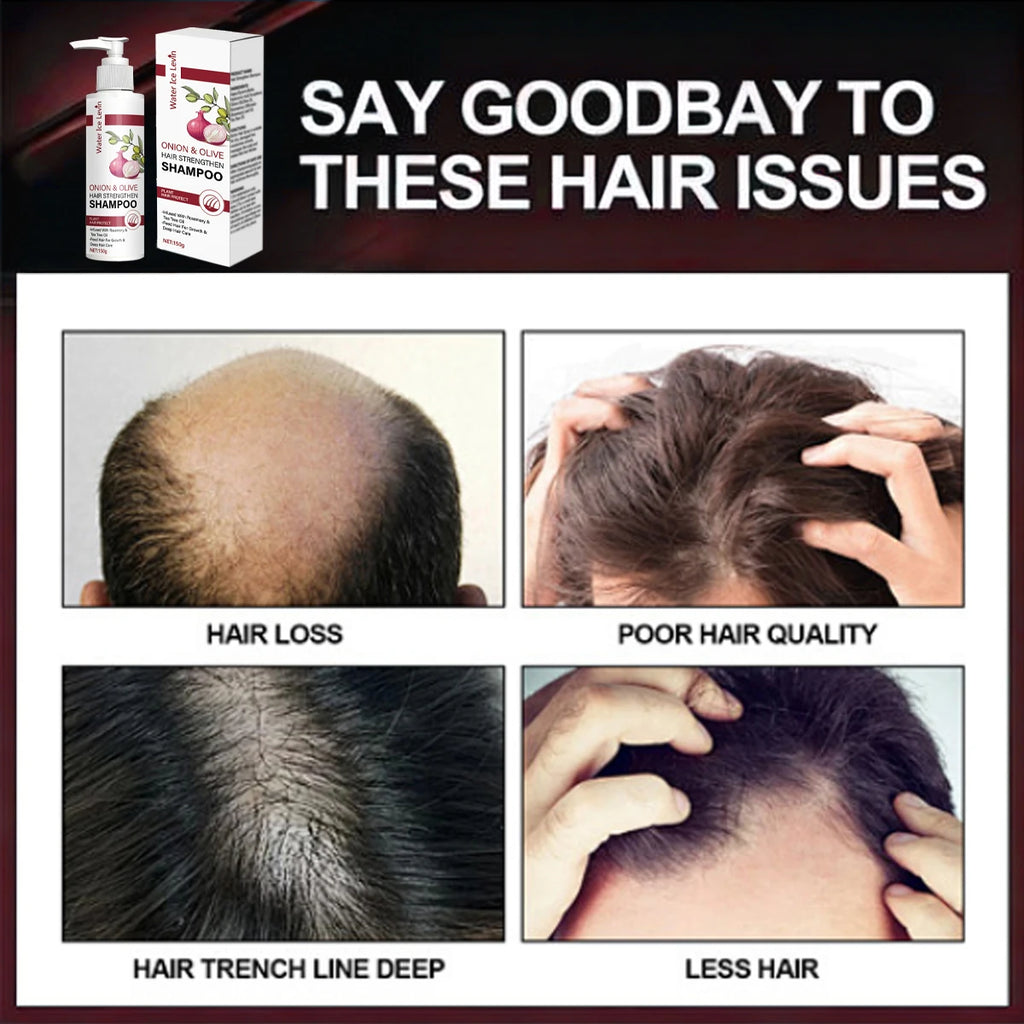 Onion & Olive Hair Strengthen Shampoo with Biotin & Rosemary Oil - Promotes Hair Growth & Deep Moisture for Dry, Damaged Hair Qme