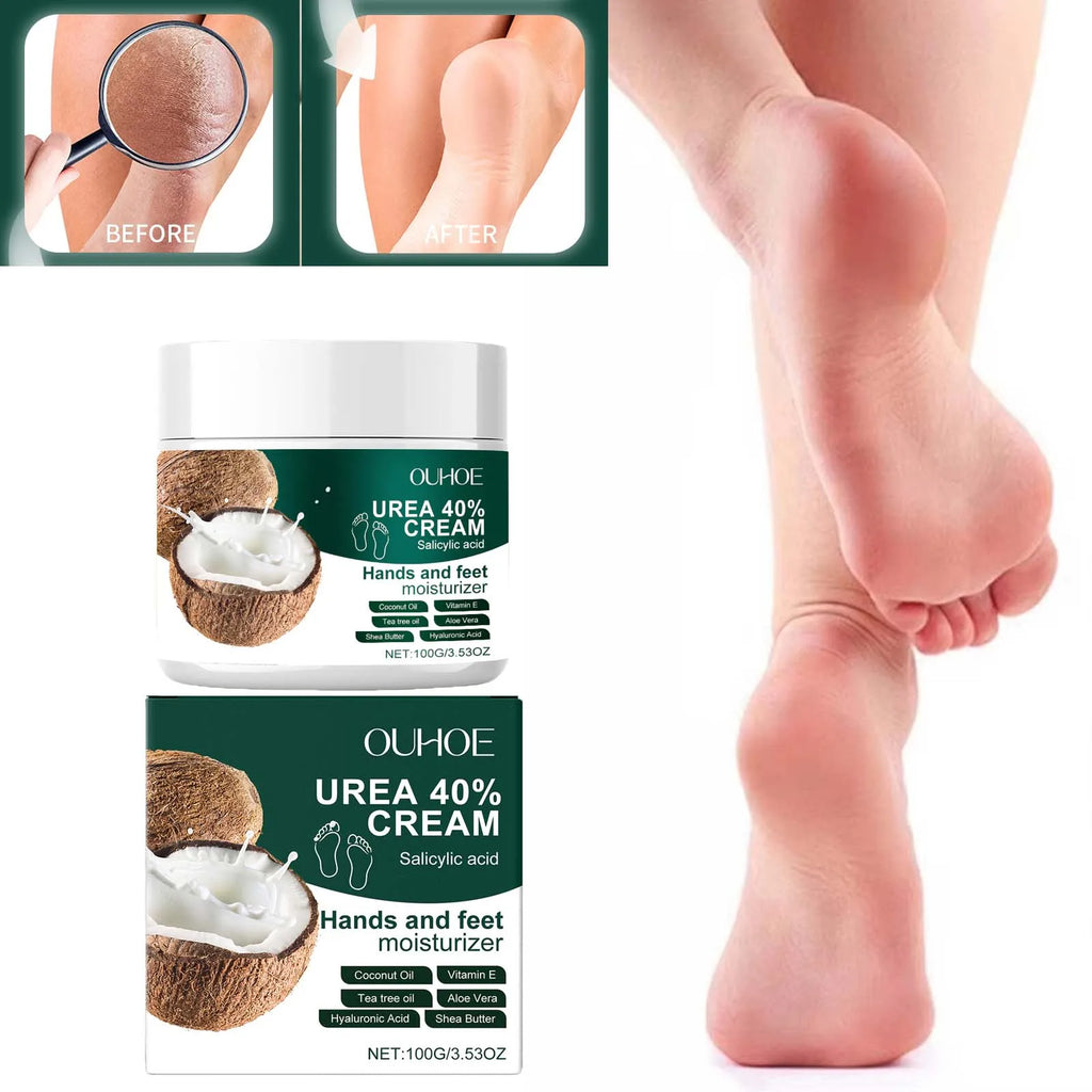 Urea 40% Cream Salicylic Acid Hand Foot Cream for Cracked Heels & Dry Skin Moisturizing Hydrating Callus Remover Smooth Skin Qme