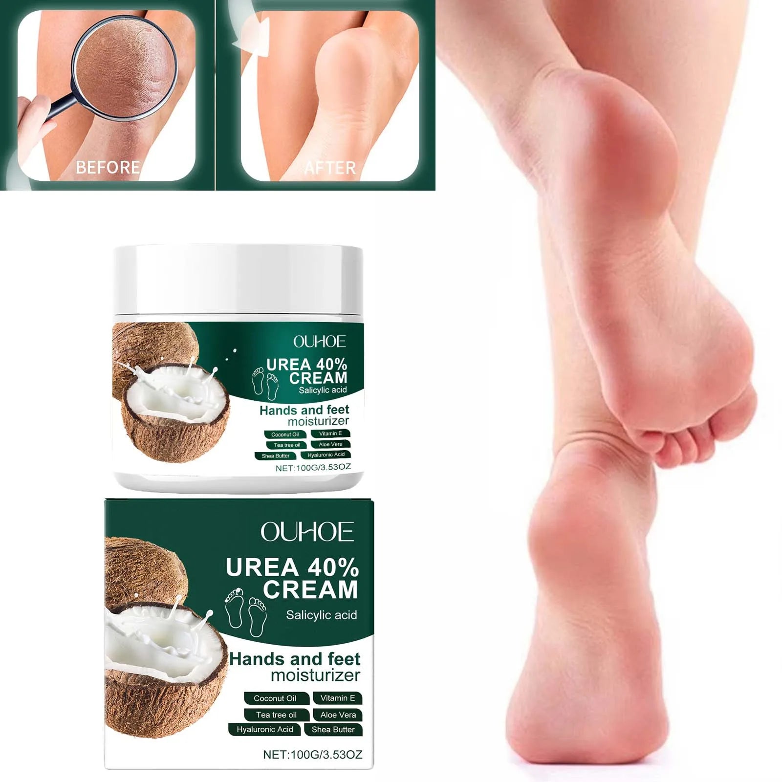 Urea 40% Cream Salicylic Acid Hand Foot Cream for Cracked Heels & Dry Skin Moisturizing Hydrating Callus Remover Smooth Skin Qme