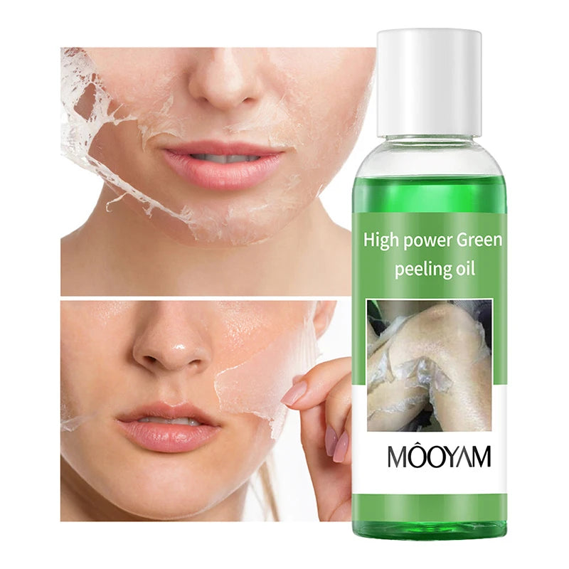 Salicylic Acid Peel-off Exfoliating Oil Removes Dead Skin Face Body Qme