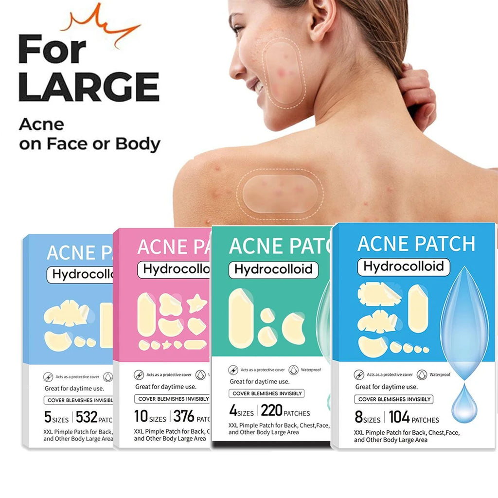 Large Pimple Patches Bulk Face 5 Sizes Hydrocolloid Acne Covering Qme