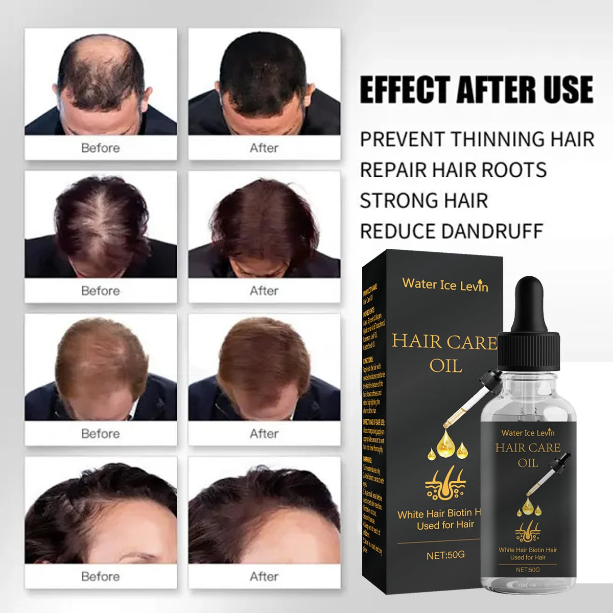 Hair Care Oil with Biotin - Fights White Hair & Boosts Moisture with Rosemary, Castor Oil, Collagen for Soft, Shiny Hair Qme