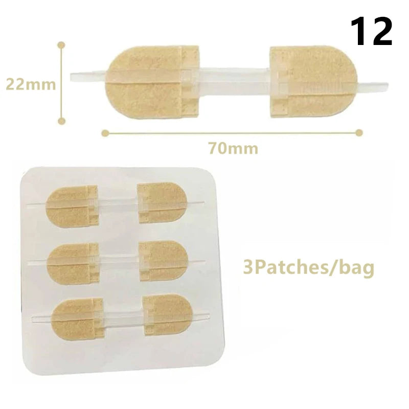 1 3 10 50 Patches Butterfly Closure Bandage Strips Adhesive Strip Qme 12 3Patches