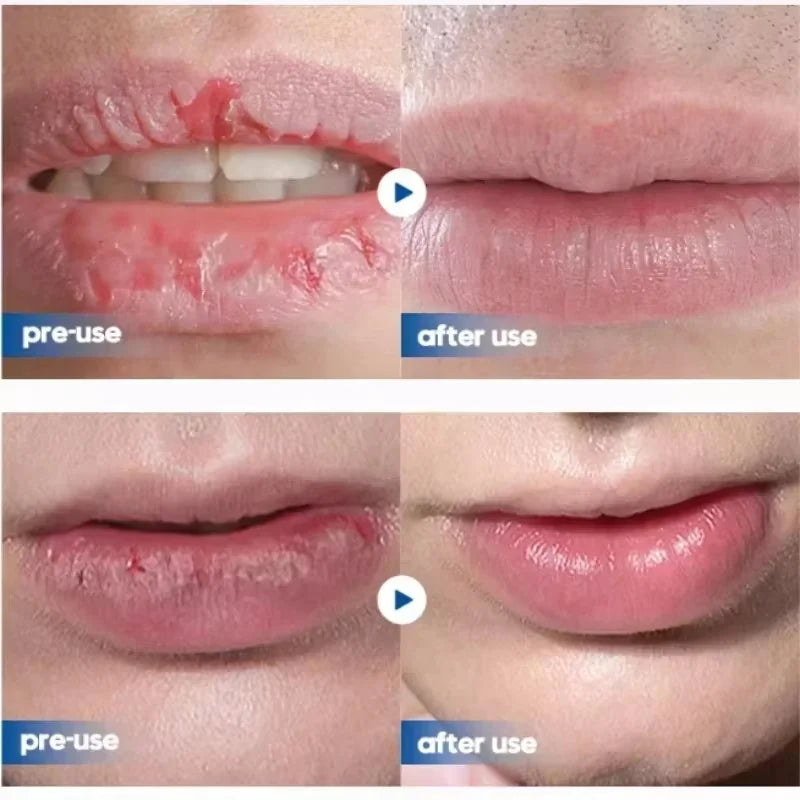 Men Lip Balm Moisturizing Hydration Fading Lip Lines Anti-Cracking Remove Dead Skin Refreshing And Not Greasy Exquisite Lip Care Qme