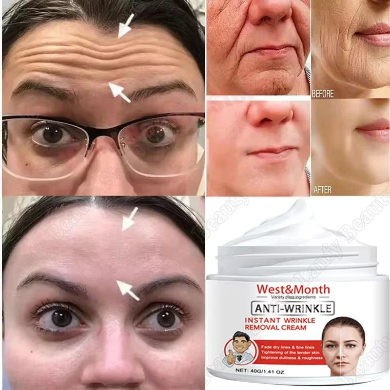 Retinol Wrinkle Removing Face Cream Anti-Aging Firming Lifting Fade Fine Lines Moisturizing Brighten Skin Care Korean Cosmetics Qme