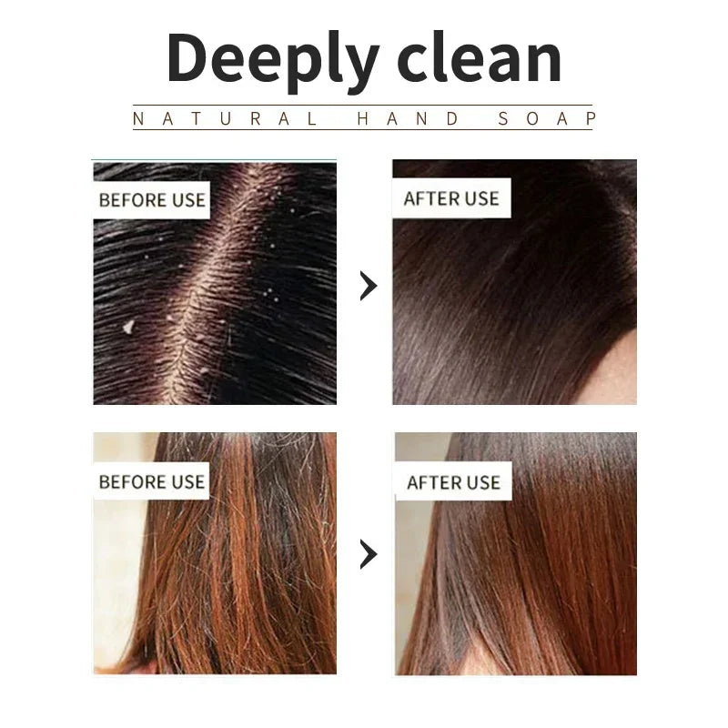 Lavender shampoo is refreshing, oil controlling, and smooth for hair, solving the problem of oily scalp without silicone oil res Qme