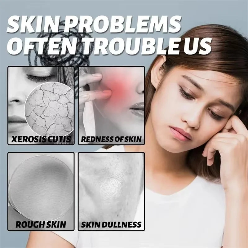 Facial Redness Repair Essence Improve Sensitive Skin Dryness Moisturizer Hydrating Sooth Lotion Removal Rosacea Korean Cosmetics Qme