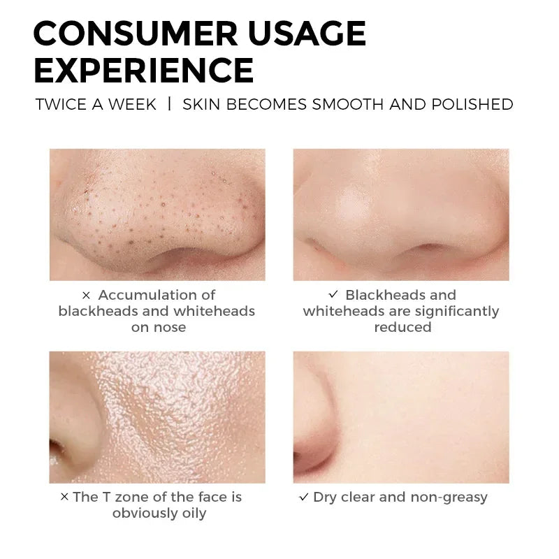 EXPRESSIONS Deep-cleansing Brightening Clay Mask Cleansing Pore Qme