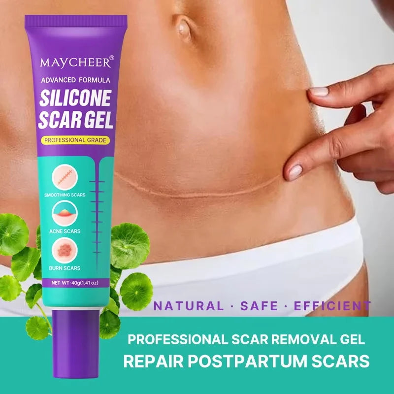 Stretch Marks Repair Cream Fade Lines Improve Duliness Tightness Long-lasting Moisturizing Smooth Enhance Elasticity Body Care Qme
