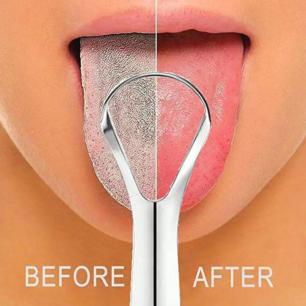 Tongue Scraper Cleaners Adults Reduce Bad Breath Fresh Metal Scrapers Qme