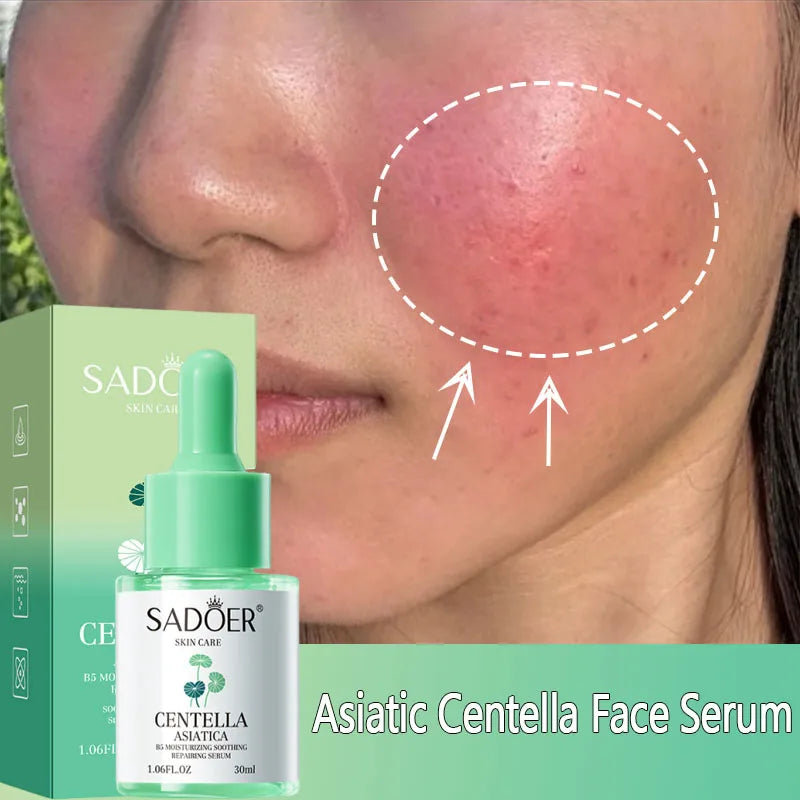 Asiatic Centella Face Serum Reduce Facial Redness Lifting Firming Faded Wrinkles Whitening Facial Essence Skin Care Product Qme