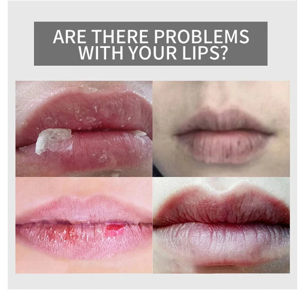 Hyaluronic Acid Collagen Sleep Lip Mask 20g Deep Hydration Lasting Moisturizing Exfoliation Day And Night Can Be Given As A Gift Qme