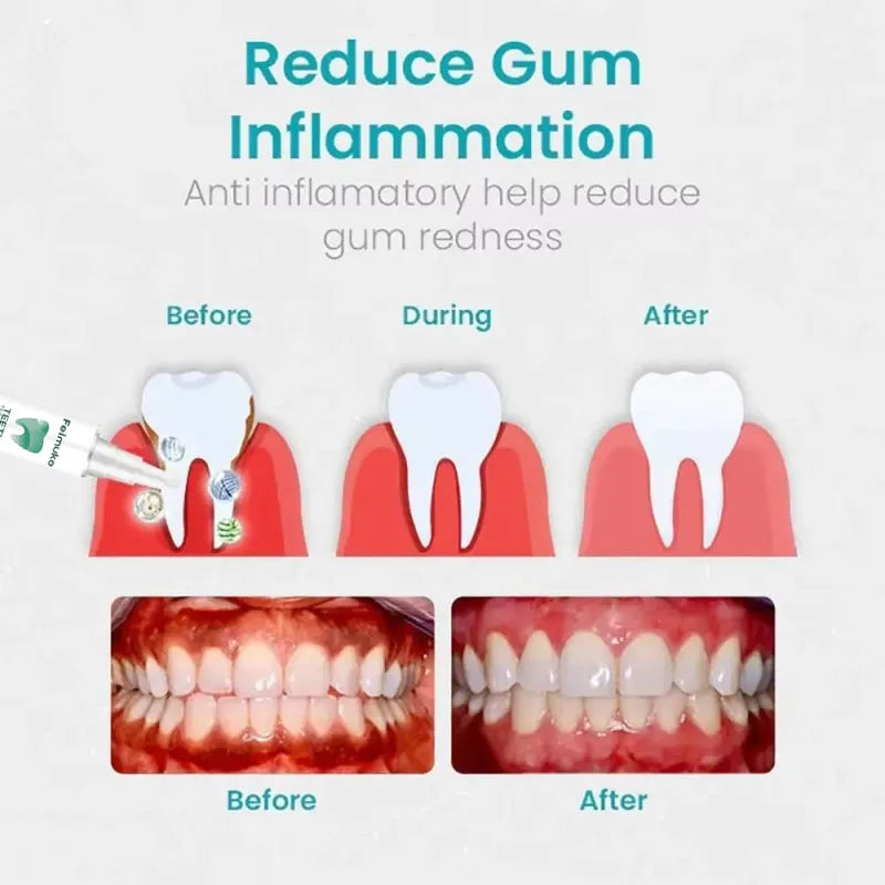 Damaged Gum Repair Care Gel Relieve Sore Gums Allergy Deep Cleaning Teeth Stains Tartar Serum Dental Caries Toothpaste Qme
