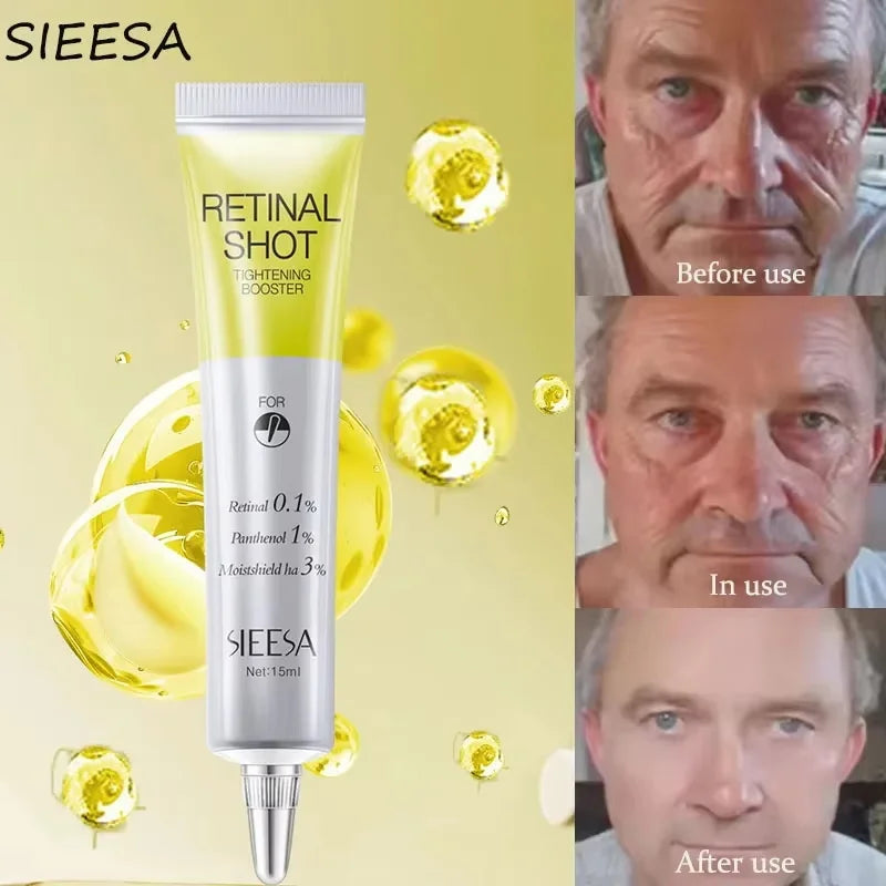 Retinol Anti-wrinkle Cream Collagen Anti-Aging Instant Removal Face Neck Wrinkle Efficient Moisturizing Firming Korean Skin Care Qme