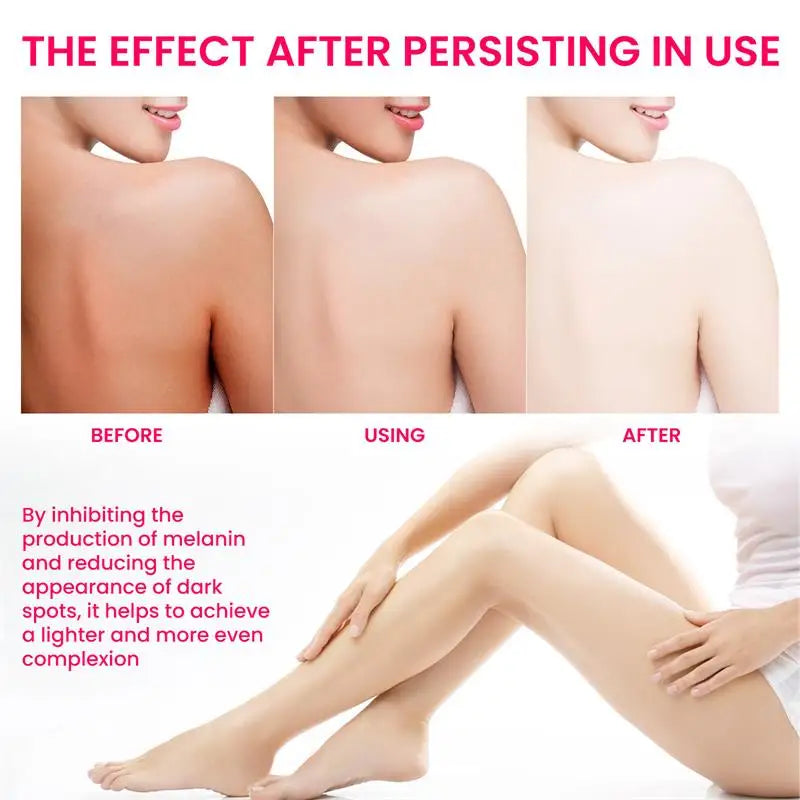 Niacinamide Whitening Cream Stick Remove Dark Spots Bleaching Private Parts Underarm Brighten Butt Knee Inner Thigh Body Care Qme
