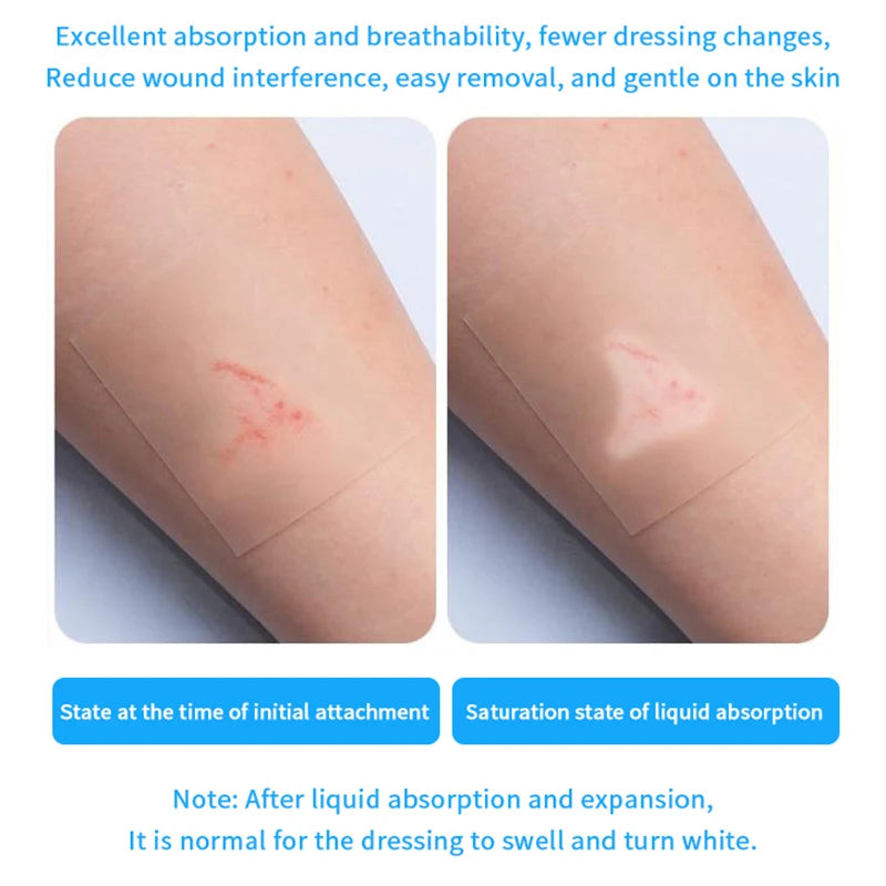 1 Self-adhesive Patches Hydrocolloid Dressing Invisibility Breathable Qme